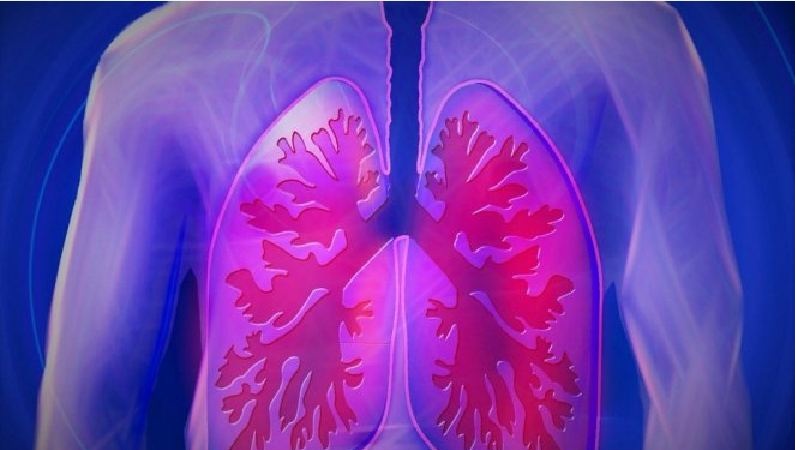 U Srbiji od raka pluća dnevno oboli čak 16 osoba