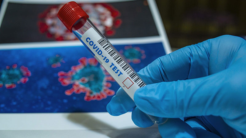 Urađeno više od 10 hiljada PCR testova u Braničevskom okrugu