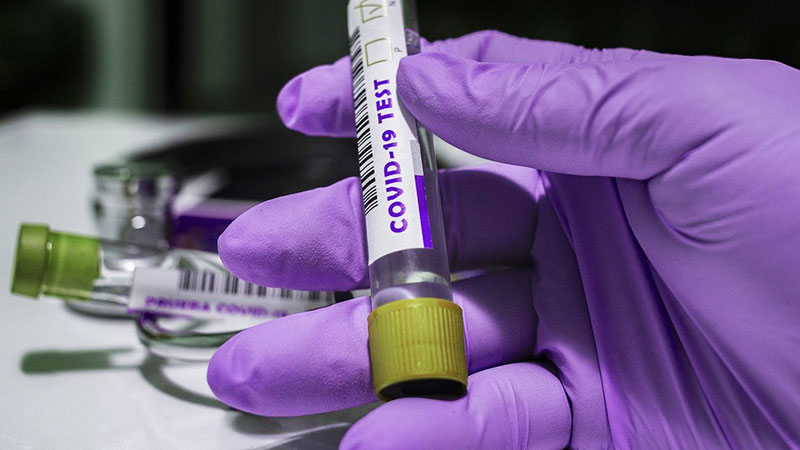 REKORD: U Srbiji čak 512 novoobolelih od koronavirusa
